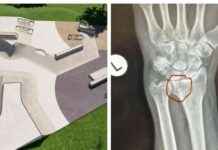 New Plymouth Mayor Injured at Skatepark Opening: What Happened? new-plymouth-mayor-njured-at-skatepark-opening-what-happened