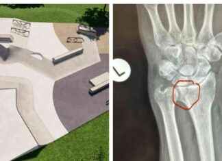 New Plymouth Mayor Injured at Skatepark Opening: What Happened? new-plymouth-mayor-njured-at-skatepark-opening-what-happened