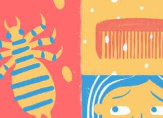 Risks of Alternative Head Lice Treatments: What Parents Should Know risks-of-alternative-head-lice-treatments-what-parents-should-know